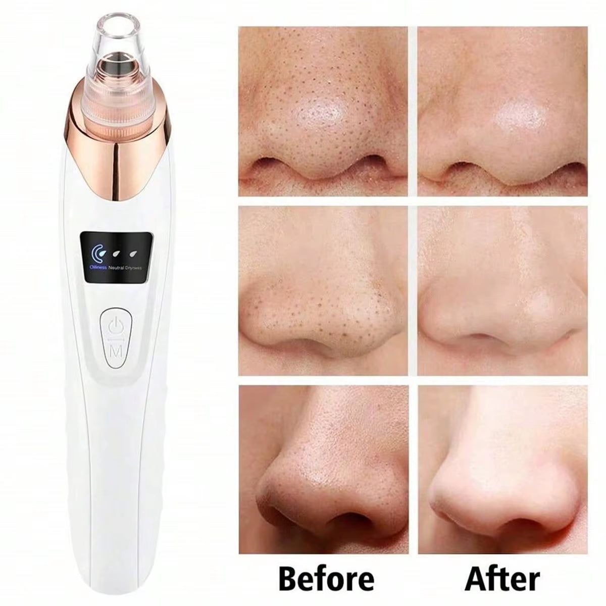Electric Pore Cleaner & Blackhead Remover